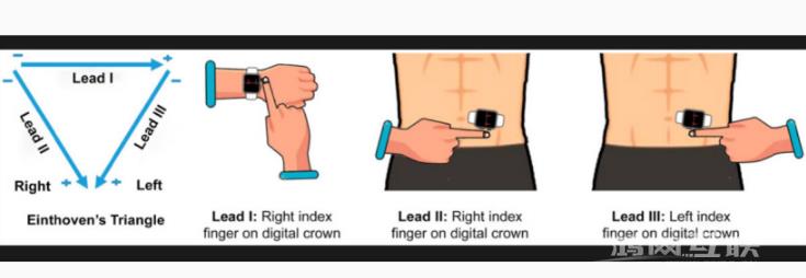 苹果 Apple  Watch具有检测潜在心脏病发作的功能插图3