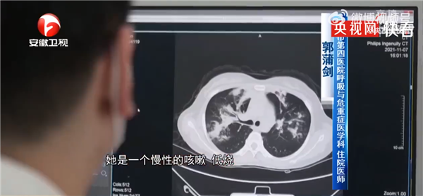 女子接触发霉玉米肺里长黄曲霉菌 没戴口罩防护:医生科普毒性超强-第1张图片-9158手机教程网 女子接触发霉玉米肺里长黄曲霉菌 没戴口罩防护:医生科普毒性超强-第1张图片-9158手机教程网