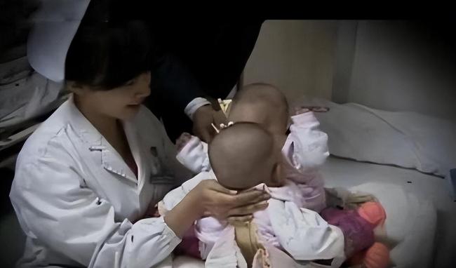 夫妻连生两胎均患怪病性别难辨:彼比相连共用一个排泄系统-第2张图片-9158手机教程网 夫妻连生两胎均患怪病性别难辨:彼比相连共用一个排泄系统-第2张图片-9158手机教程网