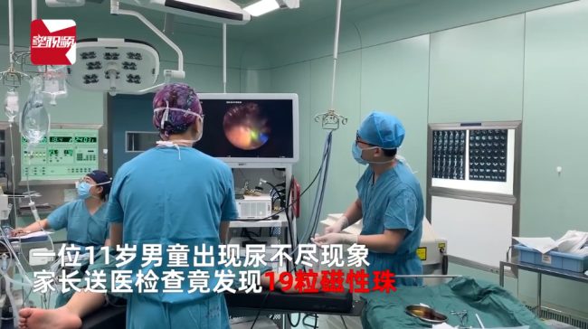 男孩膀胱塞入19粒磁珠1年后取出,都是好奇惹的祸,一直没说告知家长-第1张图片-9158手机教程网 男孩膀胱塞入19粒磁珠1年后取出,都是好奇惹的祸,一直没说告知家长-第1张图片-9158手机教程网
