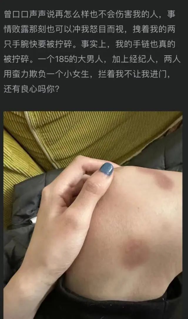 被曝出轨家暴 孙天宇公司发声明回应:理解对方,但不接受不实的指控-第4张图片-9158手机教程网 被曝出轨家暴 孙天宇公司发声明回应:理解对方,但不接受不实的指控-第4张图片-9158手机教程网