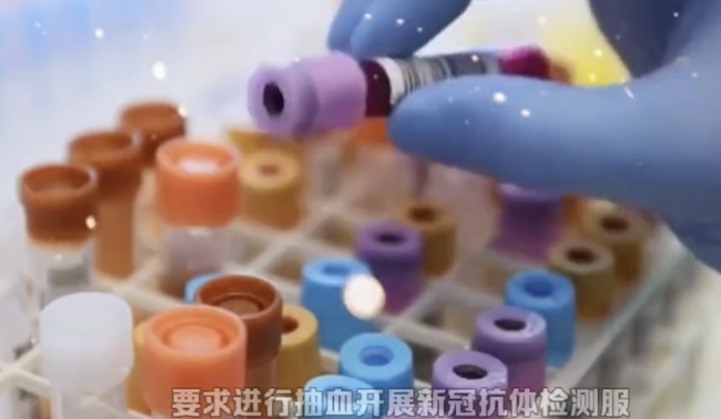 新冠抗体检测有必要吗?专家回应 对疫苗接种有一定参考意义-第1张图片-9158手机教程网 新冠抗体检测有必要吗?专家回应 对疫苗接种有一定参考意义-第1张图片-9158手机教程网