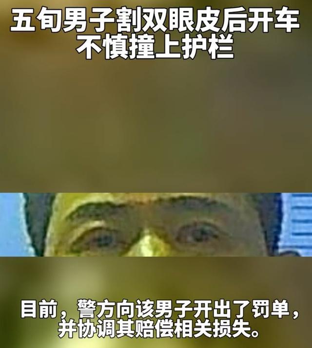 五旬男子因刚割双眼皮开车撞上护栏 都是药膏惹祸-第3张图片-9158手机教程网 五旬男子因刚割双眼皮开车撞上护栏 都是药膏惹祸-第3张图片-9158手机教程网