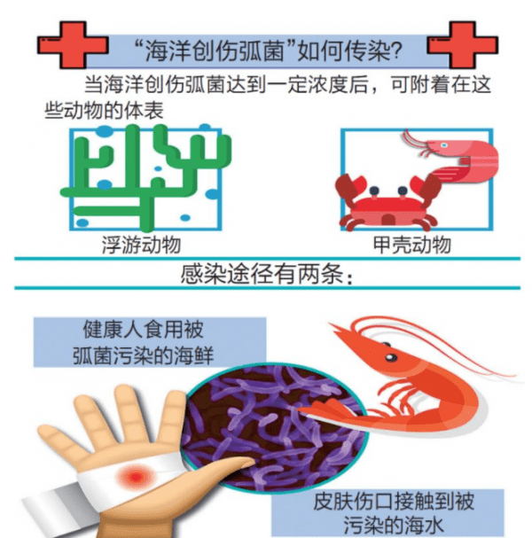 老人处理鲳鱼感染海洋创伤弧菌离世,开始症状并不明显 处理海产时一定要注意-第8张图片-9158手机教程网 老人处理鲳鱼感染海洋创伤弧菌离世,开始症状并不明显 处理海产时一定要注意-第8张图片-9158手机教程网