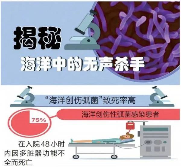 老人处理鲳鱼感染海洋创伤弧菌离世,开始症状并不明显 处理海产时一定要注意-第6张图片-9158手机教程网 老人处理鲳鱼感染海洋创伤弧菌离世,开始症状并不明显 处理海产时一定要注意-第6张图片-9158手机教程网