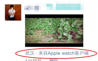 微信小尾巴显示apple watch方法