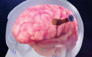 马斯克合伙人研制大脑“第七层” ：瘫痪病人可用意念操作电子设备