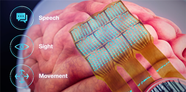 马斯克合伙人研制大脑“第七层” ：瘫痪病人可用意念操作电子设备-第3张图片-9158手机教程网